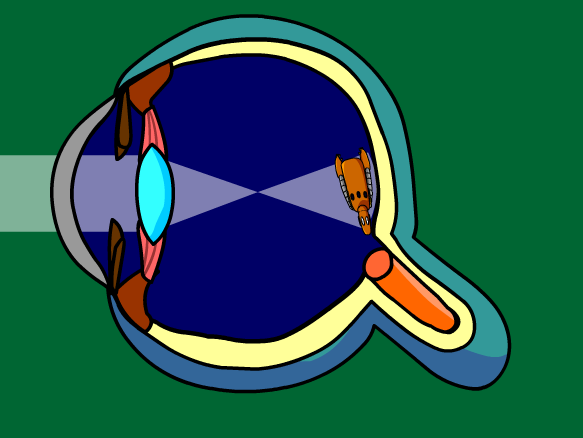 Vision Problems Animation BrainPOP